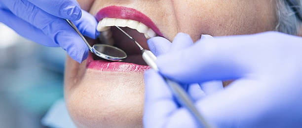 Best Emergency Dentist for Knocked-Out Tooth in Leander, TX